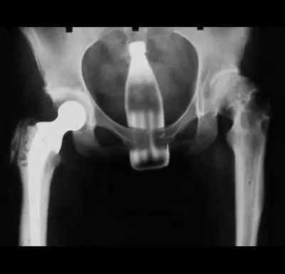 Stoke’s Guide to Sneaking Booze into Festivals